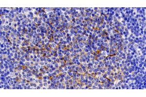 Detection of IL11Ra in Human Lymph node Tissue using Polyclonal Antibody to Interleukin 11 Receptor Alpha (IL11Ra) (IL11RA 抗体  (AA 59-220))