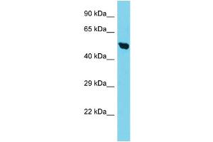 Host: Rabbit Target Name: TIMM50 Sample Type: HepG2 Whole Cell lysates Antibody Dilution: 1.