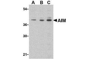 Western blot analysis of AIM in Raji lysate with AP30034PU-N AIM antibody at (A) 0. (CD5L 抗体  (C-Term))