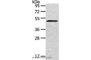 Western blot analysis of Mouse bladder tissue, using SIGLEC15 Polyclonal Antibody at dilution of 1:200