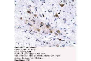 Immunohistochemistry (IHC) image for anti-Potassium Voltage-Gated Channel, Subfamily H (Eag-Related), Member 6 (KCNH6) (N-Term) antibody (ABIN2776259)