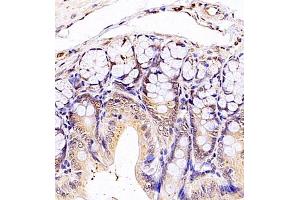 Immunohistochemistry (Paraffin-embedded Sections) (IHC (p)) image for anti-Signal Recognition Particle 14kDa (Homologous Alu RNA Binding Protein) (SRP14) antibody (ABIN7075596)