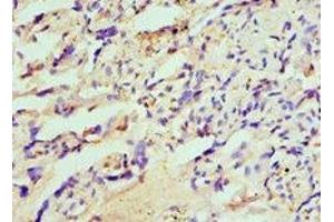 Immunohistochemistry of paraffin-embedded human placenta tissue using ABIN7155937 at dilution of 1:100 (HIP1 抗体  (AA 410-690))