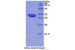 SDS-PAGE (SDS) image for Complement Factor H (CFH) ELISA Kit (ABIN6574181)
