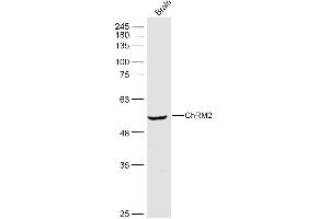 Mouse brain lysates probed with ChRM2 Polyclonal Antibody, Unconjugated  at 1:500 dilution and 4˚C overnight incubation. (Muscarinic Acetylcholine Receptor M2 抗体  (AA 381-466))