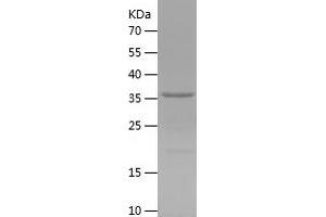 Western Blotting (WB) image for Killer Cell Lectin-Like Receptor Subfamily G, Member 1 (KLRG1) (AA 60-195) protein (His-IF2DI Tag) (ABIN7123688)
