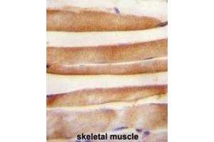 ARV1 antibody (N-term) immunohistochemistry analysis in formalin fixed and paraffin embedded human skeletal muscle followed by peroxidase conjugation of the secondary antibody and DAB staining. (ARV1 抗体  (N-Term))