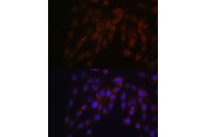 Immunofluorescence (IF) image for anti-Cut-Like Homeobox 1 (CUX1) (AA 1-280) antibody (ABIN1679438)