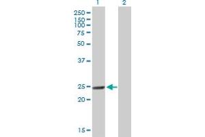 Western Blot analysis of MTHFD2 expression in transfected 293T cell line by MTHFD2 MaxPab polyclonal antibody. (MTHFD2 抗体  (AA 1-248))