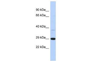 C1ORF74 antibody used at 1 ug/ml to detect target protein. (C1ORF74 抗体  (N-Term))