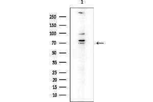 Western blot analysis of lysates from COLO205 cells, using MINPP1 Antibody at 1/1000 dilution.