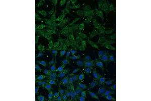Immunofluorescence analysis of L929 cells using NF-kB p65/RelA antibody (ABIN3016234, ABIN3016235, ABIN3016236 and ABIN6219643) at dilution of 1:100. (NF-kB p65 抗体  (AA 50-180))