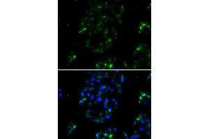 Immunofluorescence analysis of A549 cell using BOC antibody. (BOC 抗体)