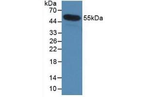 Detection of Recombinant IL35, Human using Monoclonal Antibody to Interleukin 35 (IL35) (Interleukin 35 抗体  (AA 23-219))