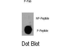 Image no. 1 for anti-Phosphoinositide-3-Kinase, Catalytic, delta Polypeptide (PIK3CD) (pTyr485) antibody (ABIN358424) (PIK3CD 抗体  (pTyr485))