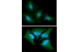 ICC/IF analysis of GOT1 in A549 cells line, stained with DAPI (Blue) for nucleus staining and monoclonal anti-human GOT1 antibody (1:100) with goat anti-mouse IgG-Alexa fluor 488 conjugate (Green). (GOT1 抗体  (AA 1-413))