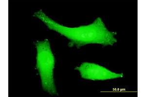 Immunofluorescence of monoclonal antibody to ITCH on HeLa cell. (ITCH 抗体  (AA 92-190))