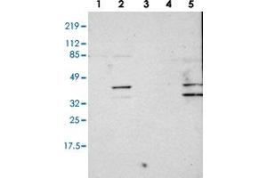 Western blot analysis of Lane 1: RT-4, Lane 2: U-251 MG, Lane 3: A-431, Lane 4: Liver, Lane 5: Tonsil with SLMAP polyclonal antibody (PAB28557).
