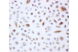 Immunocytochemistry (ICC) image for anti-Peroxiredoxin 3 (PRDX3) (AA 239-256) antibody (ABIN3032188)