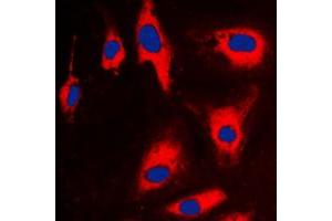 Immunofluorescent analysis of TCTP staining in CCRFCEM cells. (TPT1 抗体  (Center))