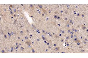 Detection of DDAH2 in Mouse Cerebrum Tissue using Polyclonal Antibody to Dimethylarginine Dimethylaminohydrolase 2 (DDAH2) (DDAH2 抗体  (AA 31-265))