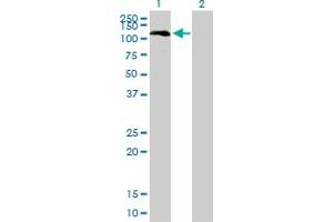 Western Blot analysis of BUB1 expression in transfected 293T cell line by BUB1 monoclonal antibody (M01), clone 4C3-4C9. (BUB1 抗体  (AA 1-1085))