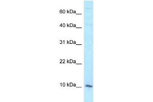 WB Suggested Anti-DAP Antibody Titration: 1. (DAP 抗体  (Middle Region))