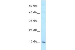 WB Suggested Anti-DAP Antibody Titration: 1. (DAP 抗体  (Middle Region))