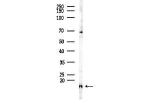 Western blot analysis of lysates from COLO205 cells(heat-shock,45 min treatment), using TIMM13 Antibody at 1/1000 dilution.
