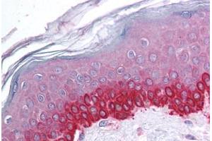 Human Skin (formalin-fixed, paraffin-embedded) stained with CTCF antibody ABIN214093 at 5 ug/ml followed by biotinylated goat anti-rabbit IgG secondary antibody ABIN481713, alkaline phosphatase-streptavidin and chromogen. (CTCF 抗体  (N-Term))