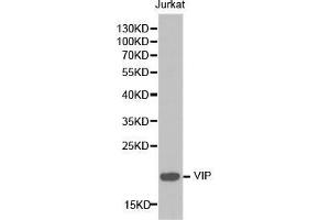Western blot analysis of extracts of Jurkat cell lines, using VIP antibody. (Vip 抗体  (AA 31-170))