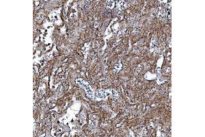 IHC analysis of EHD3 using anti-EHD3 antibody (ABIN7602777). (EHD3 抗体  (C-Term))