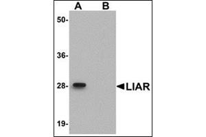 Western blot analysis of LIAR in mouse kidney tissue lysate with this product at 1 μg/ml in (A) the absence and (B) the presence of blocking peptide. (ANKRD54 抗体  (C-Term))