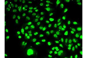 Immunofluorescence analysis of HeLa cell using NAMPT antibody. (NAMPT 抗体  (AA 1-280))