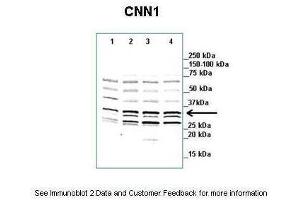 Western Blotting (WB) image for anti-Calponin 1 (CNN1) (N-Term) antibody (ABIN2783251)