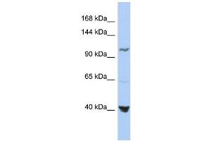 Western Blotting (WB) image for anti-Methylenetetrahydrofolate Dehydrogenase (NADP+ Dependent) 1, Methenyltetrahydrofolate Cyclohydrolase, Formyltetrahydrofolate Synthetase (MTHFD1) (Middle Region) antibody (ABIN2782515)