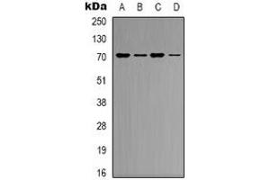 Western blot analysis of KEAP1 expression in K562 (A), Hela (B), mouse heart (C), mouse brain (D) whole cell lysates. (KEAP1 抗体)