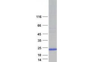 Western Blotting (WB) image for Chromosome 20 Open Reading Frame 30 (C20orf30) (Transcript Variant 4) protein (Myc-DYKDDDDK Tag) (ABIN2715477)