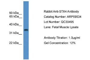 WB Suggested Anti-STX4  Antibody Titration: 0. (Syntaxin 4 抗体  (C-Term))