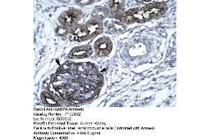 Human kidney (GABPA 抗体  (C-Term))