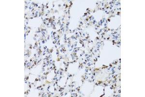 Immunohistochemistry of paraffin-embedded rat lung using MAPK3 Antibody (ABIN5970057) at dilution of 1/100 (40x lens). (ERK1 抗体  (N-Term))
