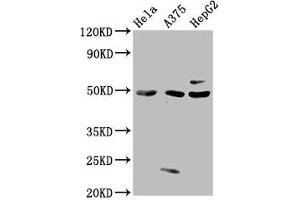 Western Blot Positive WB detected in: Hela whole cell lysate, A375 whole cell lysate, HepG2 whole cell lysate All lanes: STK24 antibody at 3 μg/mL Secondary Goat polyclonal to rabbit IgG at 1/50000 dilution Predicted band size: 50, 48 kDa Observed band size: 50 kDa (STK24 抗体  (AA 1-431))