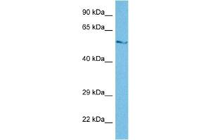 Host:  Rabbit  Target Name:  SGSH  Sample Tissue:  Human THP-1 Whole Cell  Antibody Dilution:  1ug/ml (SGSH 抗体  (N-Term))