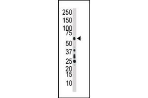 Western blot analysis of anti-TAK1 Pab (ABIN392466 and ABIN2842053) in HL60 cell lysate. (TR4 抗体  (C-Term))