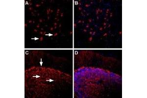 Expression of β1-Adrenoceptor in rat and mouse brain - Immunohistochemical staining of rat dorsal raphe nucleus and mouse cerebellum using Anti-β1-Adrenergic Receptor (extracellular) Antibody (ABIN7042902, ABIN7043924 and ABIN7043925), (1:400). (ADRB1 抗体  (Extracellular))