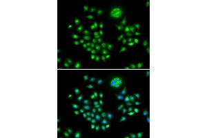 Immunofluorescence (IF) image for anti-HIV-1 Rev Binding Protein (HRB) antibody (ABIN1980310) (AGFG1 抗体)