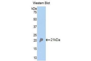 Western Blotting (WB) image for anti-Complement Factor P (CFP) (AA 310-459) antibody (ABIN1173602) (CFP 抗体  (AA 310-459))