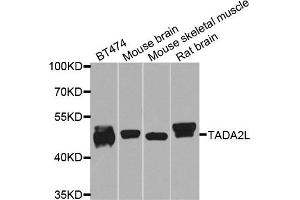 Western blot analysis of extracts of various cells, using TADA2A antibody. (TADA2L 抗体)