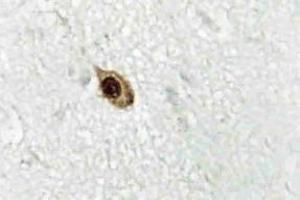Immunohistochemistry (IHC) analyzes of Zic1/2/3 antibody in paraffin-embedded human brain tissue. (ZIC1 抗体)