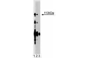 Western blot analysis of Itch on rat liver lysate. (ITCH 抗体  (AA 114-220))